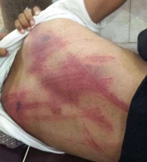 على طريقة تعذيب عبدالله الاغبري تعذيب شاب في صنعاء(صور مفزعة)
