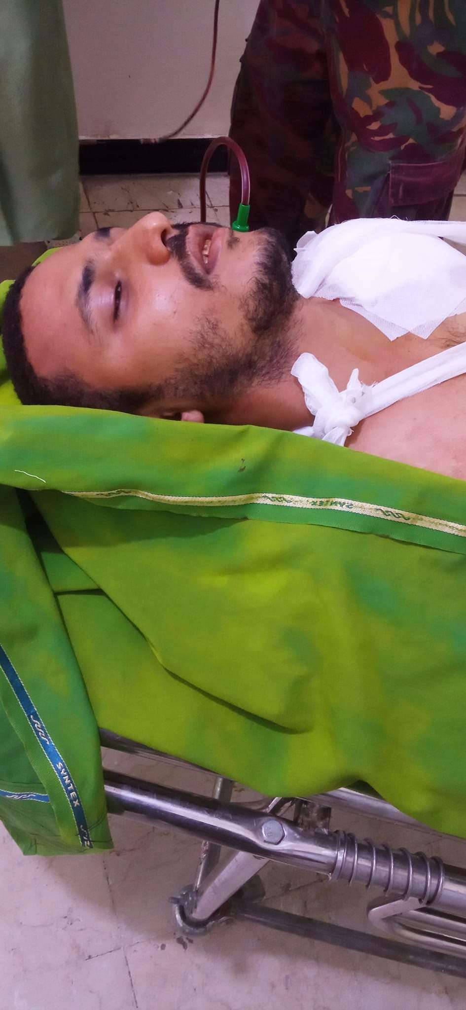 الكشف عن الحالة الصحية لأحد مرافقي اللواء المجيدي الذي تعرض لهجوم حوثي