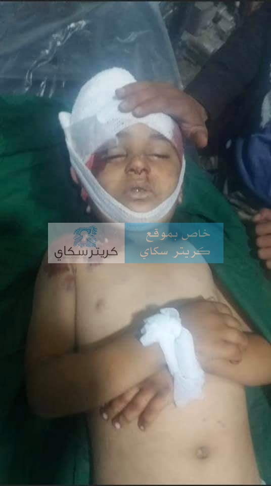 جريمة قتل تهز صنعاء (صور)
