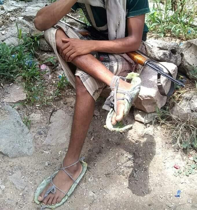 صورة محزنة ..  تلخص حال الجندي اليمني