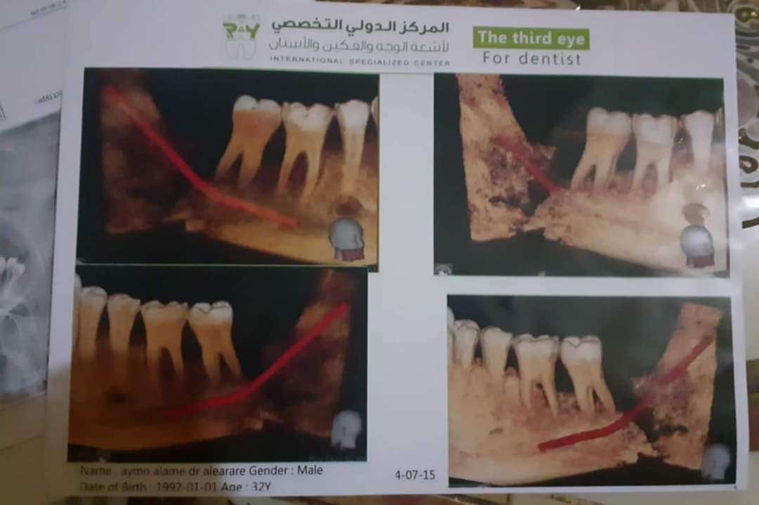 في موقف انساني نبيل.. مستشار رئاسي ينقذ حياة اعلامي بعدن