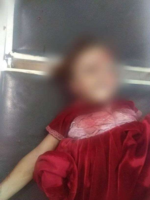 عاجل :وفاة طفلة أثر حادث مروري دهس في لحج