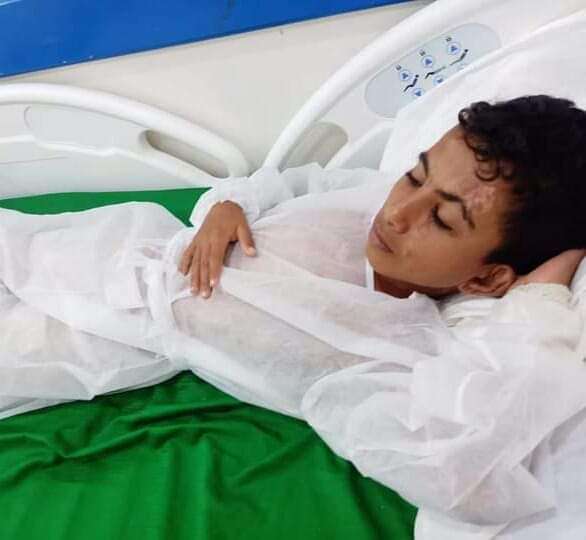 عقب تعرضه لانفجار قذيفة .. الطفل علاء يخضع لإجراء عملية جراحية في المخا